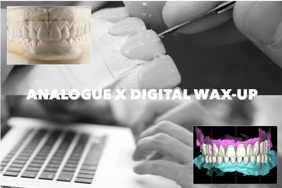 analogue x digital wax-up