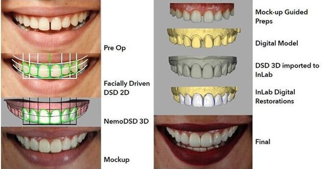 digital restoration workflow