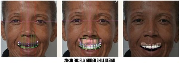 2D/3D facially guided smile design