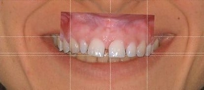 intraoral photo