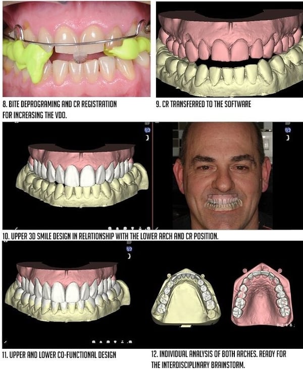 interdisciplinary simulations & final treatment plan