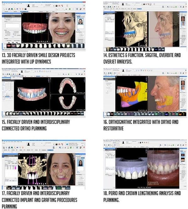 smile design guided dental brainstorm