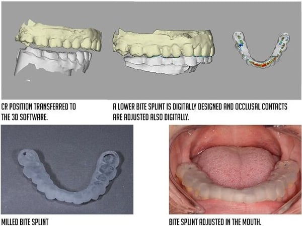 reproducible and healthy inter-maxillary position