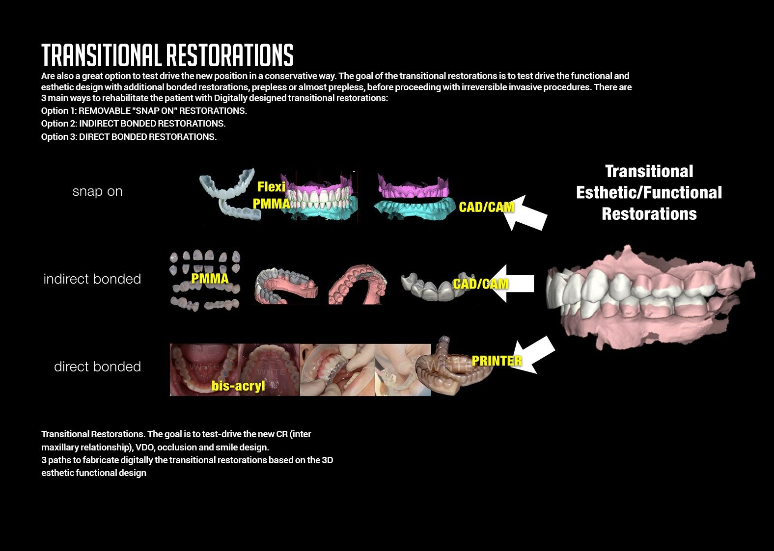 Transitional Restorations