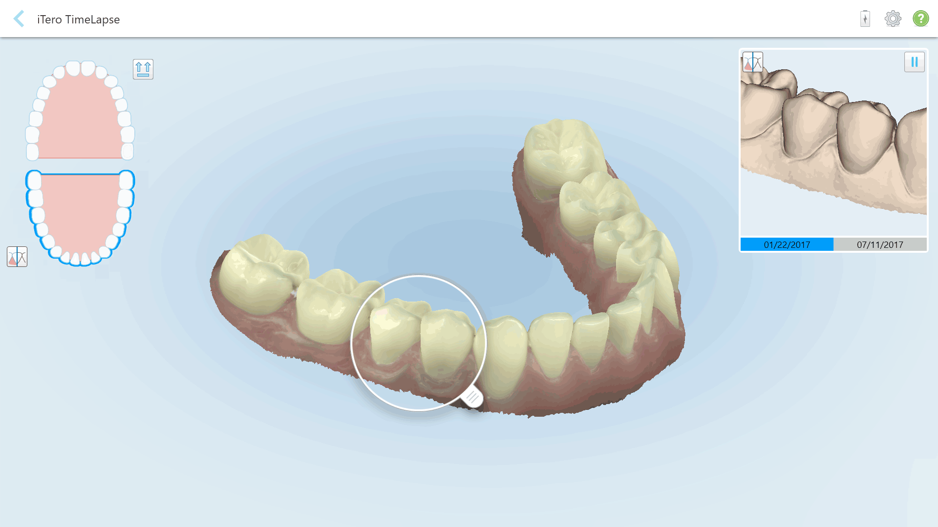 Using intraoral scanners to create great stories for your patients